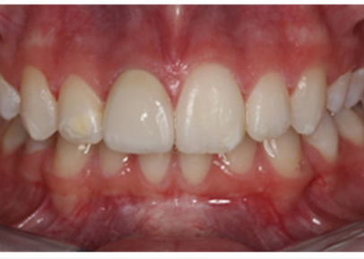 Case 1 After