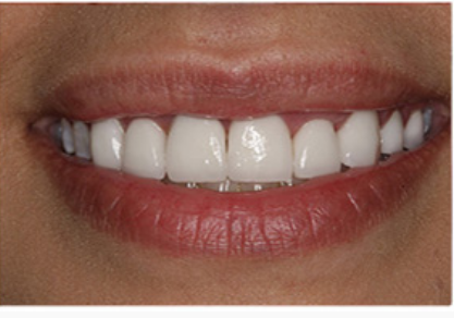 Case 2 After
